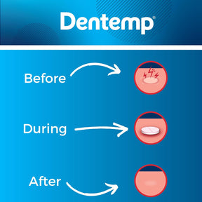 Dentemp Canker Cover P/ Tratamento De Aftas Com 6 Tabletes