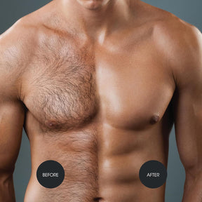 Nad's Hair For Men - Creme Depilatório Masculino Corpo 200ml